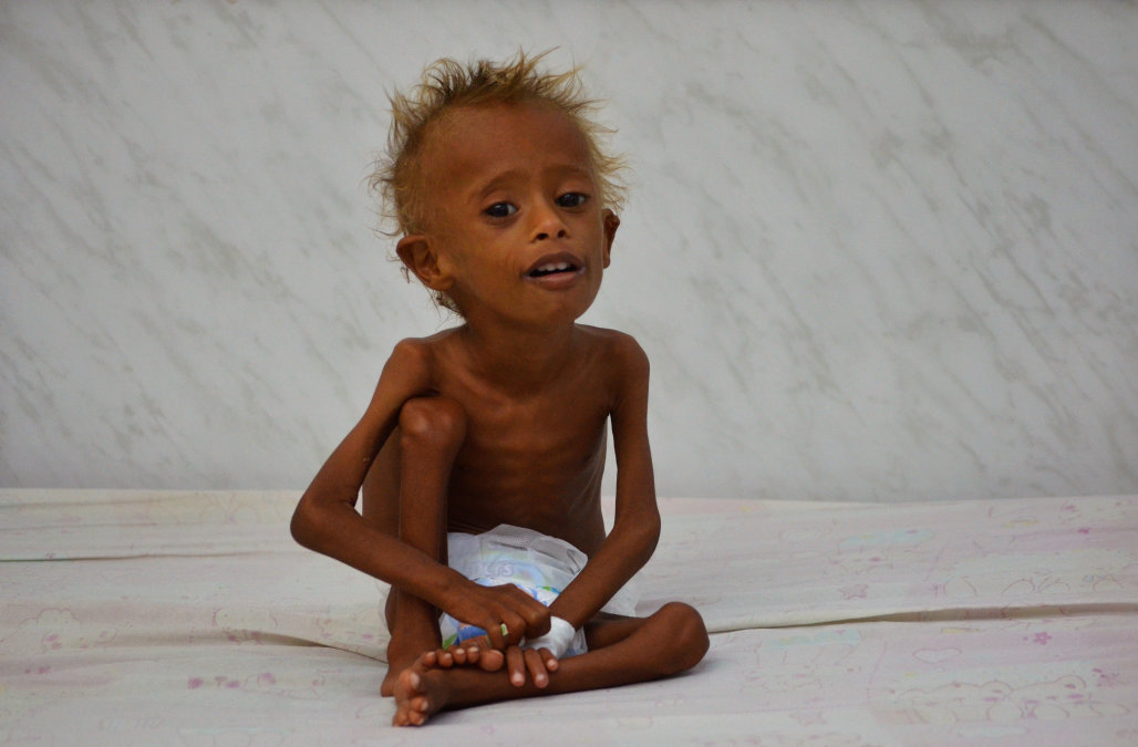 Over one million Yemeni children at risk of cholera: Charity